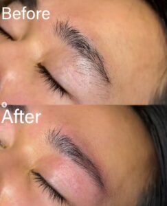 メンズ眉毛脱毛大阪