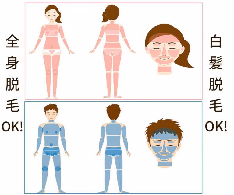 全身脱毛大阪
