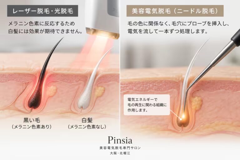 美容電気脱毛とレーザー